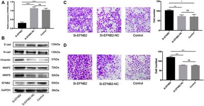 Corrigendum: miR-193a-3p Mediates Placenta Accreta Spectrum Development by Targeting EFNB2 via Epithelial-Mesenchymal Transition Pathway Under Decidua Defect Conditions